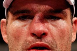 Golpes-de-Dan-Henderson-deixam-Mauricio-Shogun-com-o-nariz-torto